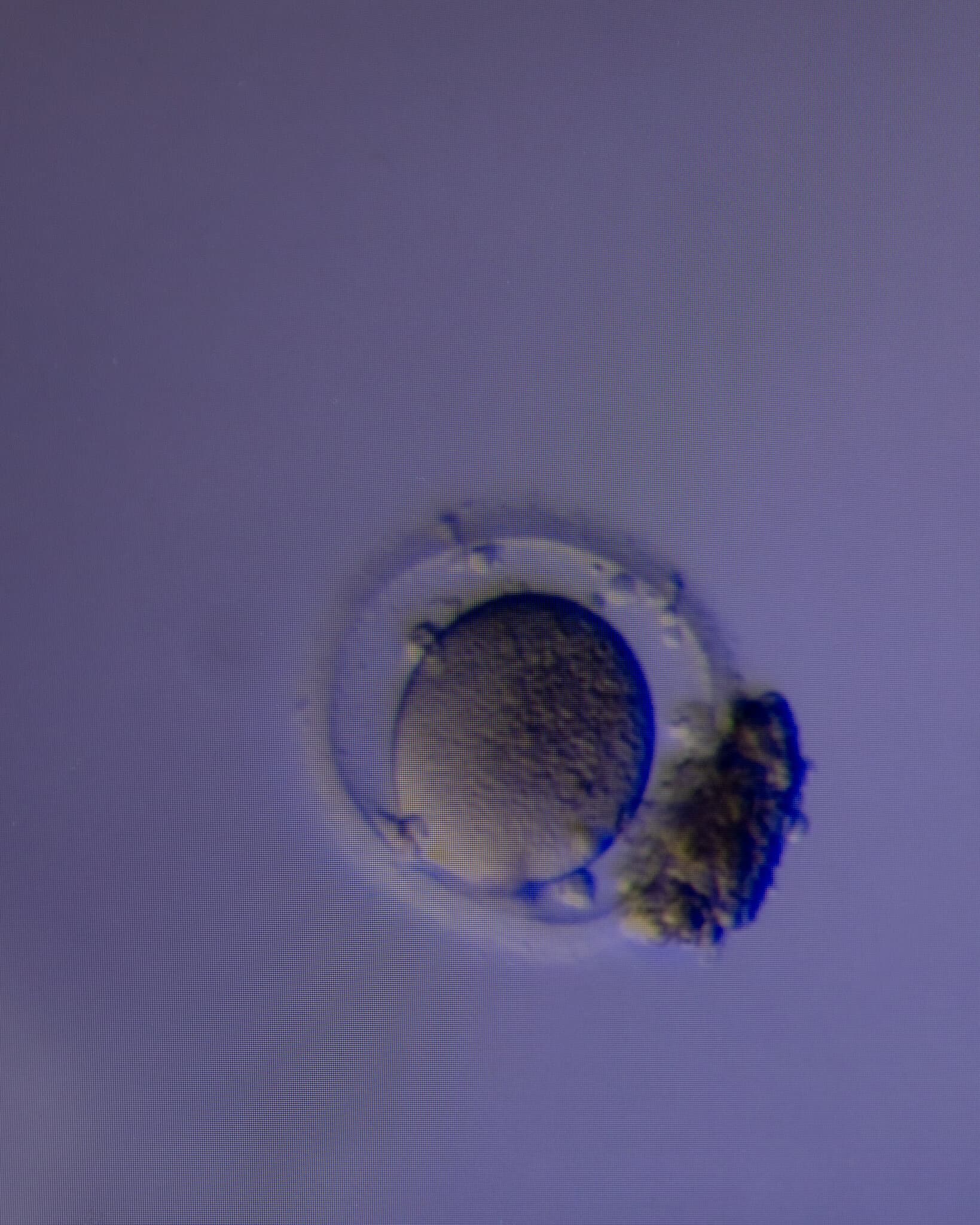 New Method Can Find Hidden Eggs to Aid in Fertility Treatment