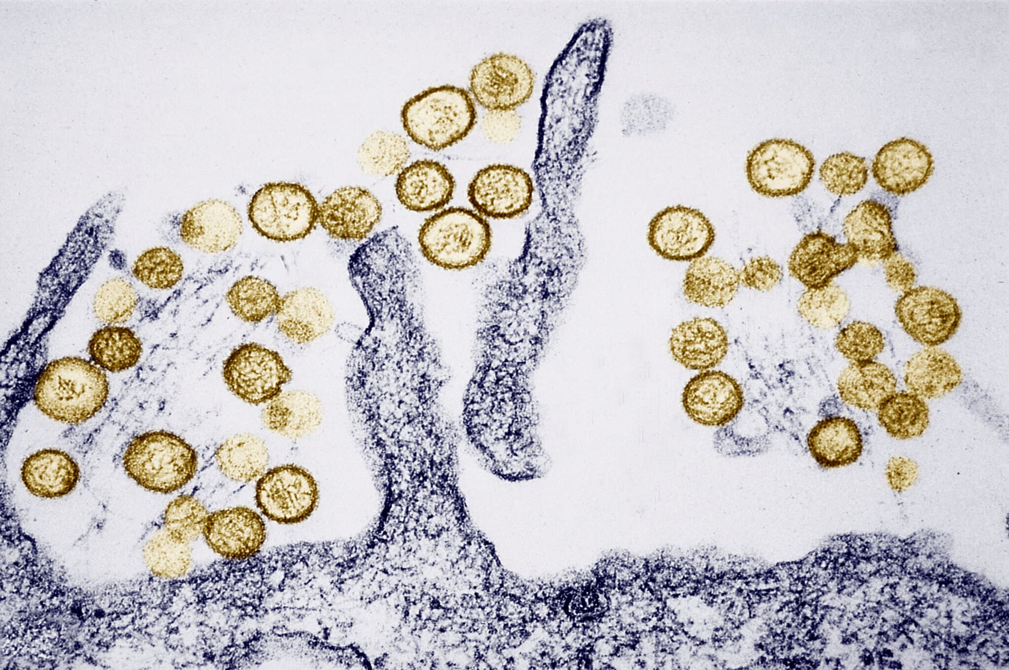 What Is Hantavirus, Which Is Linked to the Deaths of 3 People Aboard a Cruise Ship?