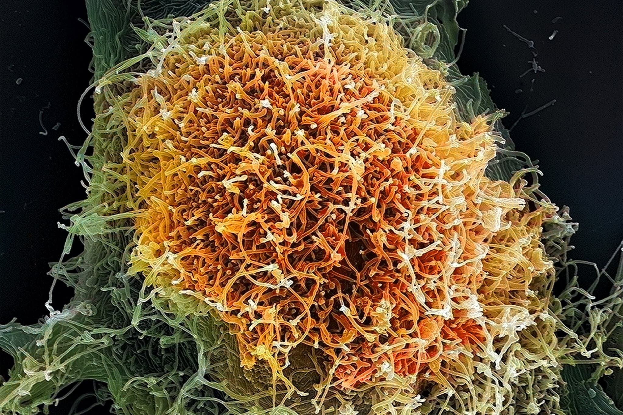 The Viruses Causing New Outbreaks Are Much Less Familiar to Science