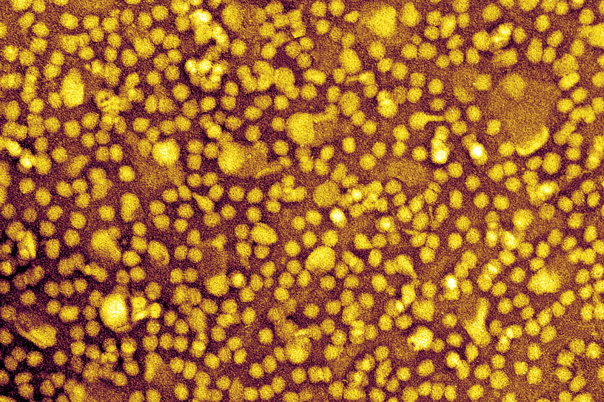 One-and-Done Heart Disease Prevention? Scientists Show It May Be Possible.