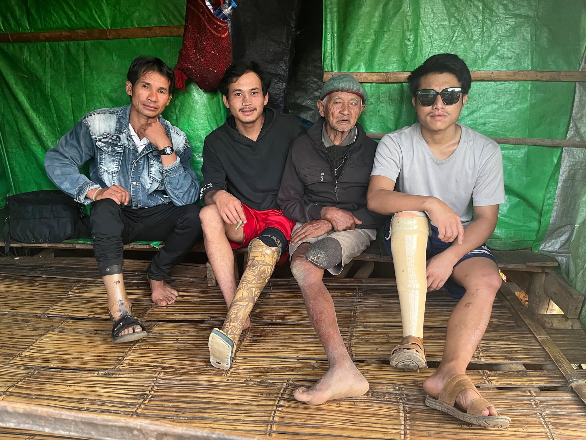 A Family Ravaged by Land Mines