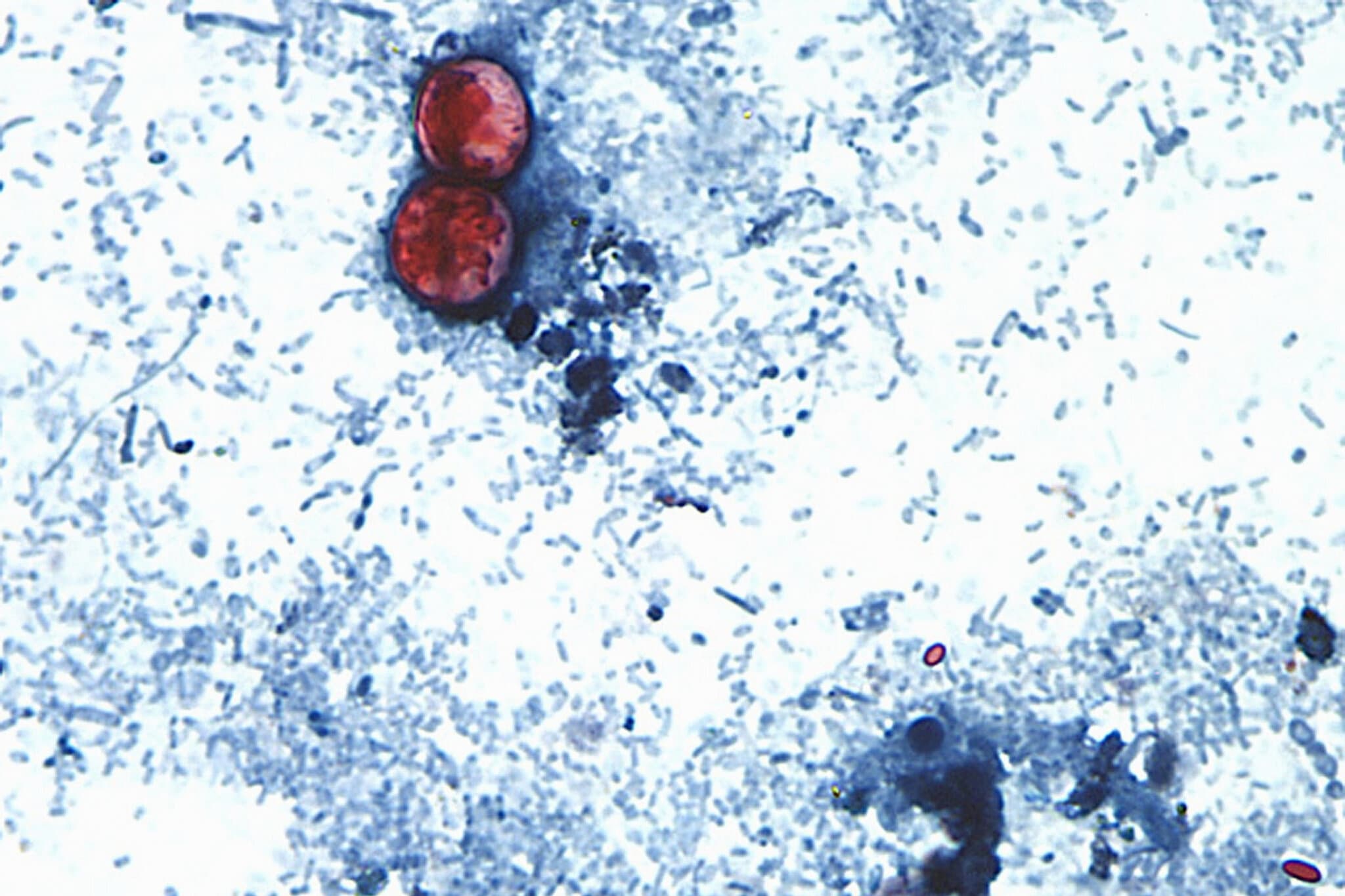Cyclospora Spreads Through Human Feces. How Did It Get Into Our Food Supply?
