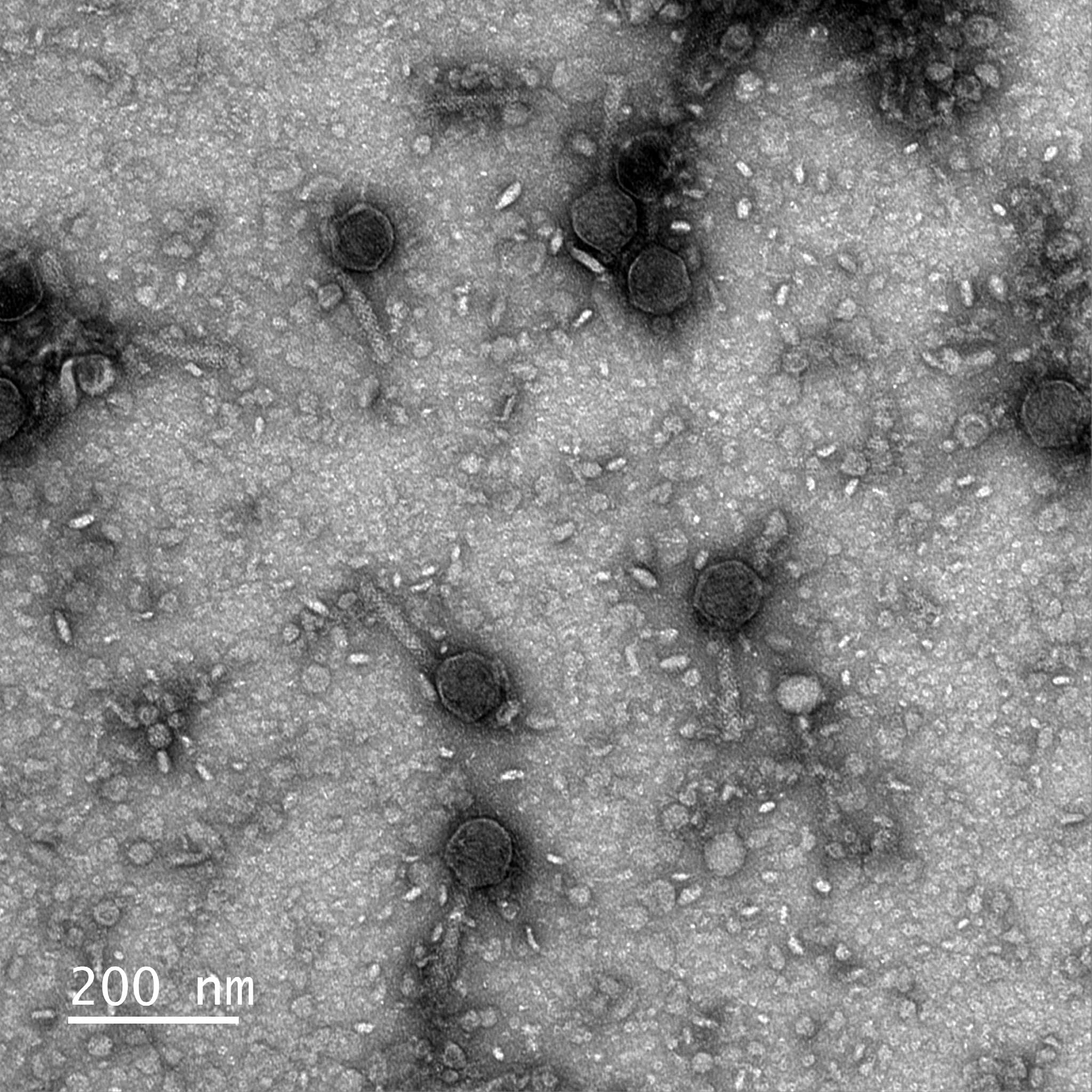 The Next Gene-Editing Technology May Also Be the Oldest